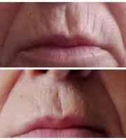 Anagenessis: Φυτικά βλαστοκύτταρα που προστατεύουν και δίνουν νεότητα στην επιδερμίδα