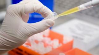 Αλεξανδρούπολη: Εμβολιασμοί για τη λύσσα και τοποθέτηση τσιπ σε σκύλους.