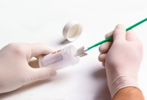 Δωρεάν προληπτικό HPV test στα χωριά Φυλάκιο και Βάλτο