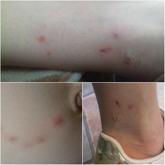 Έξαρση από ψύλλους σε πολλές περιοχές της Σαμοθράκης