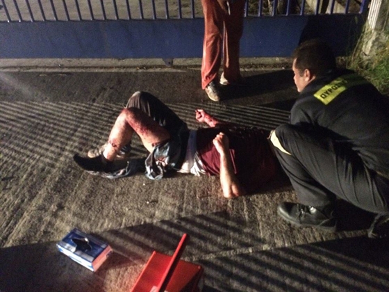 Άγρια επίθεση σκύλων σε 50χρονο - Σοβαρή η κατάστασή της υγείας του στο ΠΓΝΕ