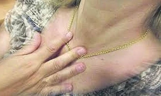 Αλεξανδρούπολη: Αγκαλιάζουν και κλέβουν χρυσαφικά από ηλικιωμένες που περπατούν ανυποψίαστες στο δρόμο