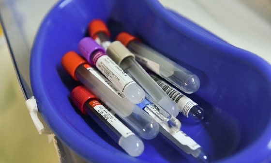 Ανεβαίνει ο αριθμός των κρουσμάτων από τον γάμο στην Αλεξανδρούπολη 