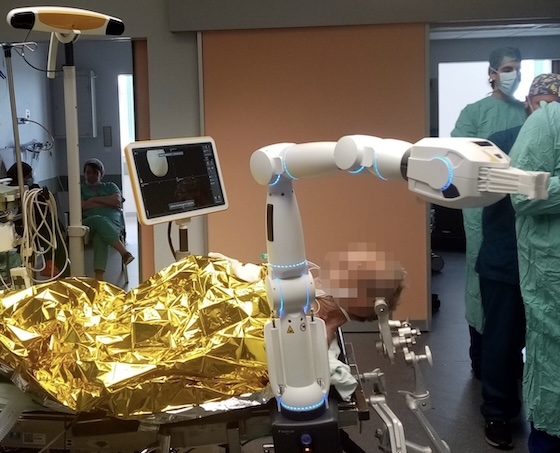 Το ΠΓΝ Αλεξανδρούπολης πρωτοπορεί: Χειρούργησαν όγκο εγκεφάλου με ιατρικό ρομπότ!