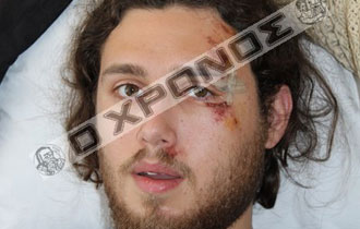 Αρνήθηκαν να πληρώσουν όταν ο σερβιτόρος δεν τους έφερε την απόδειξη για το λογαριασμό.